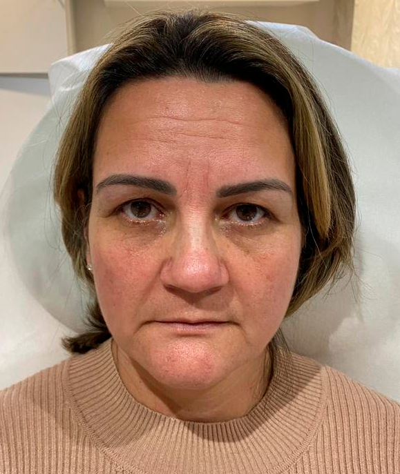 imagem-antes-atualizada imagem-antes-atualizada